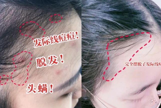 ”入冬洗头干发神器！养出女明星绸缎发！冰球突破豪华版手机版国产变态“抽水帽(图13)